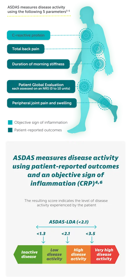 Rheuma-nr-axSpA-asas40-Disease-Activity-Mobile