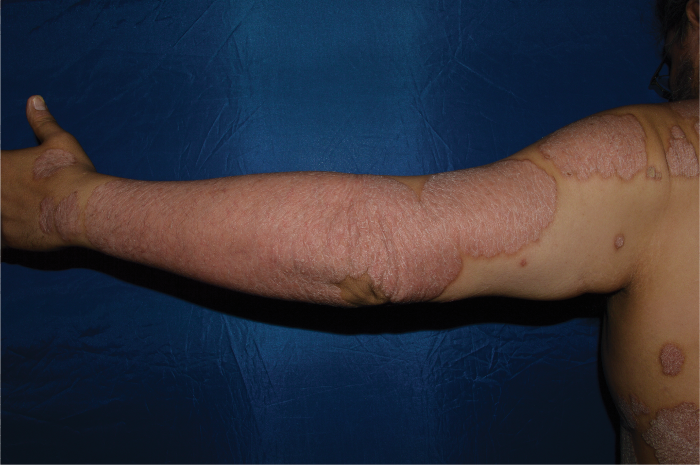 transformative skin