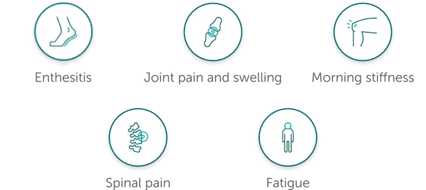 Rheuma-AS-PROS-BASDAI-Disease-Activity