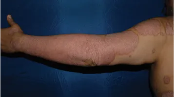 transformative skin clearance mobile