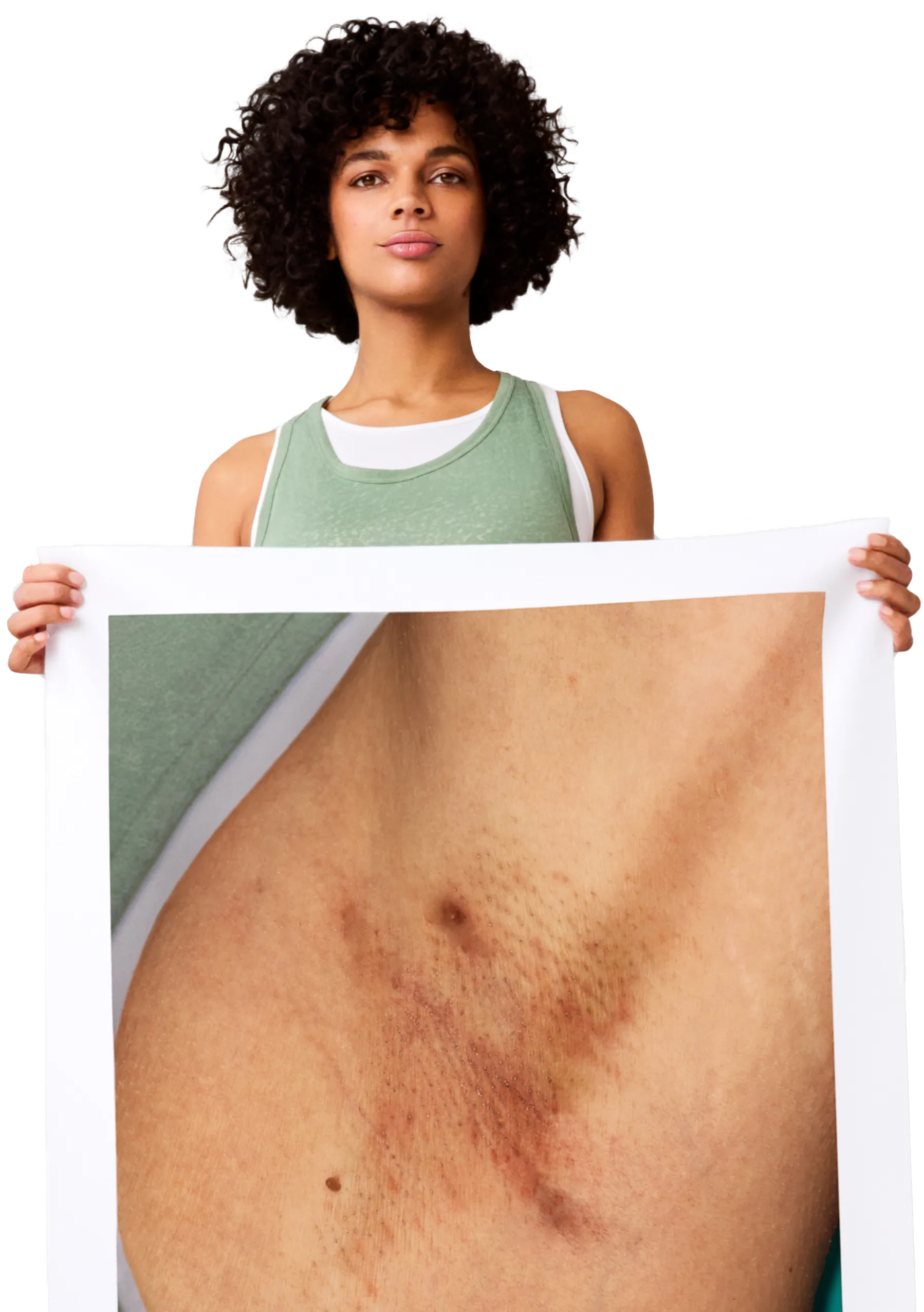 Dermatology